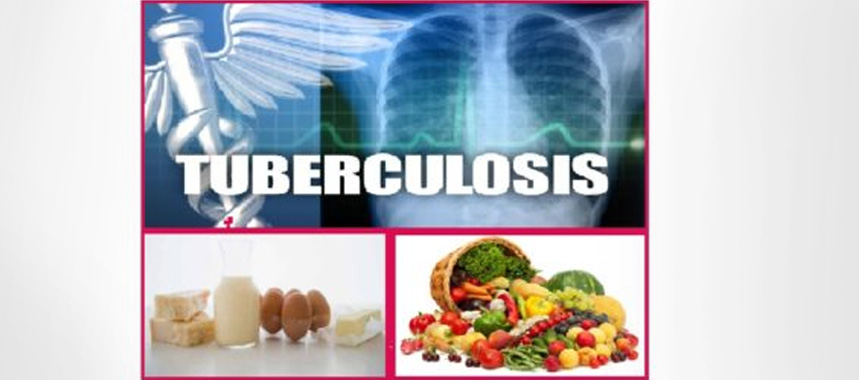 Tuberculosis Diet